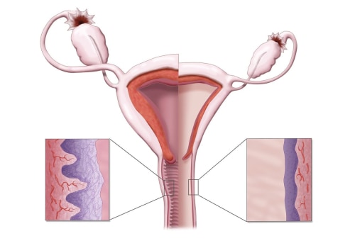 The Impact of Menopause on Vaginal Health