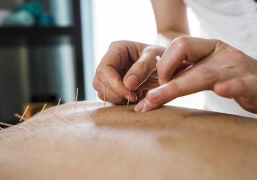 Acupuncture for Natural Relief from Menopausal Symptoms